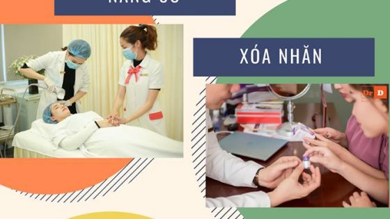 Nâng cơ xóa nhăn UltraPlus là công nghệ độc quyền chỉ có tại DrD