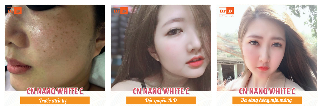 Nano-white-c-3